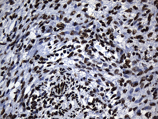 HNRNPH1 / hnRNP H Antibody - Immunohistochemical staining of paraffin-embedded Human Ovary tissue within the normal limits using anti-HNRNPH1 mouse monoclonal antibody. (Heat-induced epitope retrieval by 1mM EDTA in 10mM Tris buffer. (pH8.5) at 120°C for 3 min. (1:500)