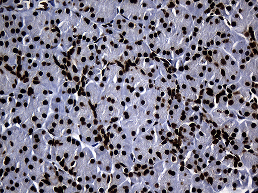 HNRNPH1 / hnRNP H Antibody - Immunohistochemical staining of paraffin-embedded Human pancreas tissue within the normal limits using anti-HNRNPH1 mouse monoclonal antibody. (Heat-induced epitope retrieval by 1mM EDTA in 10mM Tris buffer. (pH8.5) at 120°C for 3 min. (1:500)