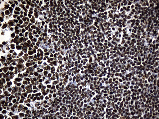 HNRNPH1 / hnRNP H Antibody - Immunohistochemical staining of paraffin-embedded Human tonsil within the normal limits using anti-HNRNPH1 mouse monoclonal antibody. (Heat-induced epitope retrieval by 1mM EDTA in 10mM Tris buffer. (pH8.5) at 120°C for 3 min. (1:500)