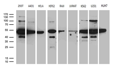 HNRNPH1 / hnRNP H Antibody - Western blot analysis of extracts. (35ug) from 9 different cell lines by using anti-HNRNPH1 monoclonal antibody. (1:500)