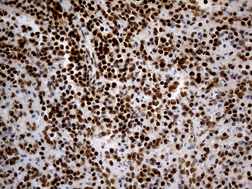 HNRNPH1 / hnRNP H Antibody - Immunohistochemical staining of paraffin-embedded Human spleen tissue within the normal limits using anti-HNRNPH1 mouse monoclonal antibody. (Heat-induced epitope retrieval by Tris-EDTA(1:500)