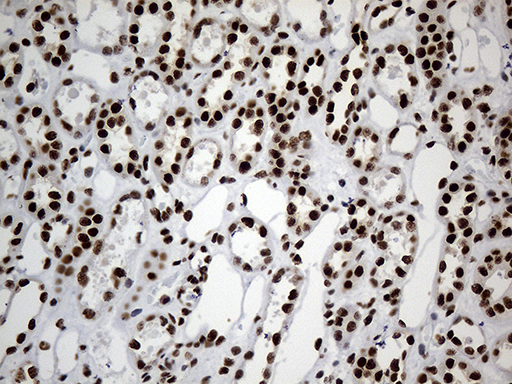 HNRNPH1 / hnRNP H Antibody - Immunohistochemical staining of paraffin-embedded Human Kidney tissue within the normal limits using anti-HNRNPH1 mouse monoclonal antibody. (Heat-induced epitope retrieval by 1mM EDTA in 10mM Tris buffer. (pH8.5) at 120°C for 3 min. (1:500)