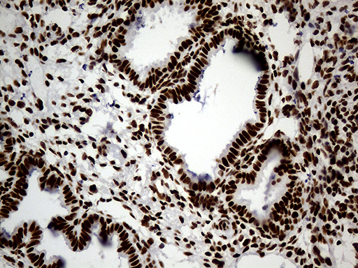 HNRNPH1 / hnRNP H Antibody - Immunohistochemical staining of paraffin-embedded Human endometrium tissue within the normal limits using anti-HNRNPH1 mouse monoclonal antibody. (Heat-induced epitope retrieval by 1mM EDTA in 10mM Tris buffer. (pH8.5) at 120°C for 3 min. (1:500)