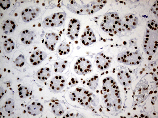 HNRNPH1 / hnRNP H Antibody - Immunohistochemical staining of paraffin-embedded Human gastric tissue within the normal limits using anti-HNRNPH1 mouse monoclonal antibody. (Heat-induced epitope retrieval by Tris-EDTA(1:500)