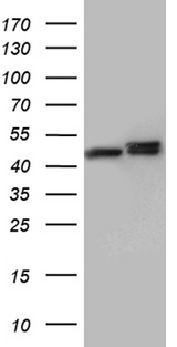 HNRNPH1 / hnRNP H Antibody - HEK293T cells were transfected with the pCMV6-ENTRY control. (Left lane) or pCMV6-ENTRY HNRNPH1. (Right lane) cDNA for 48 hrs and lysed. Equivalent amounts of cell lysates. (5 ug per lane) were separated by SDS-PAGE and immunoblotted with anti-HNRNPH1. (1:2000)