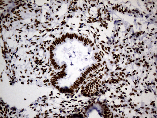 HNRNPH1 / hnRNP H Antibody - Immunohistochemical staining of paraffin-embedded Human endometrium tissue within the normal limits using anti-HNRNPH1 mouse monoclonal antibody. (Heat-induced epitope retrieval by 1mM EDTA in 10mM Tris buffer. (pH8.5) at 120°C for 3 min. (1:500)