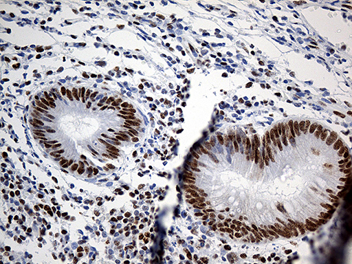 HNRNPH1 / hnRNP H Antibody - Immunohistochemical staining of paraffin-embedded Human appendix tissue within the normal limits using anti-HNRNPH1 mouse monoclonal antibody. (Heat-induced epitope retrieval by 1mM EDTA in 10mM Tris buffer. (pH8.5) at 120°C for 3 min. (1:500)