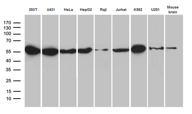 HNRNPH1 / hnRNP H Antibody - Western blot analysis of extracts. (35ug) from 8 cell lines and human brain tissue lysate by using anti-HNRNPH1 monoclonal antibody. (1:500)