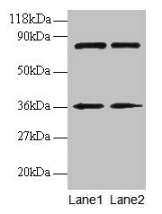 HNRNPH1 / hnRNP H Antibody - Western blot All lanes: DNA-directed RNA polymerases I, II, and III subunit RPABC2 antibody at 2µg/ml Lane 1: EC109 whole cell lysate Lane 2: 293T whole cell lysate Secondary Goat polyclonal to rabbit IgG at 1/15000 dilution Predicted band size: 49 kDa Observed band size: 36 kDa