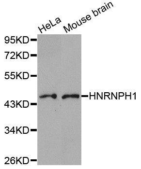 HNRNPH1 / hnRNP H Antibody - Western blot analysis of extracts of various cell lines.