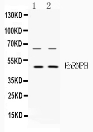 HNRNPH1 / hnRNP H Antibody - Western blot - Anti-HnRNP H Picoband Antibody