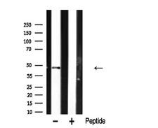 HNRNPH1 / hnRNP H Antibody - Western blot analysis of hnRNP H expression in rat kidney lysate