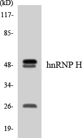 HNRNPH2 / hnRNP H2 Antibody - Western blot analysis of the lysates from 293 cells using hnRNP H antibody.