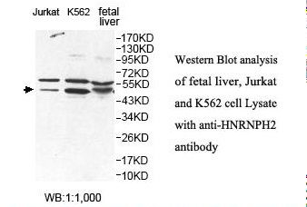HNRNPH2 / hnRNP H2 Antibody