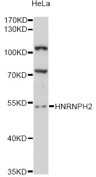 HNRNPH2 / hnRNP H2 Antibody - Western blot analysis of extracts of HeLa cells, using HNRNPH2 antibody at 1:3000 dilution. The secondary antibody used was an HRP Goat Anti-Rabbit IgG (H+L) at 1:10000 dilution. Lysates were loaded 25ug per lane and 3% nonfat dry milk in TBST was used for blocking. An ECL Kit was used for detection and the exposure time was 90s.