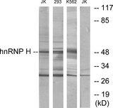 HNRNPH2 / hnRNP H2 Antibody - Western blot analysis of extracts from Jurkat cells, 293 cells and K562 cells, using hnRNP H antibody.