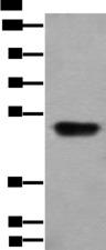 HNRNPH2 / hnRNP H2 Antibody - Western blot analysis of Human fetal liver tissue lysate  using HNRNPH2 Polyclonal Antibody at dilution of 1:400