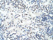 HNRNPH3 / hnRNP H3 Antibody - HNRNPH3 / HNRPH3 antibody ARP40721_T100-NP_036339-HNRPH3 (heterogeneous nuclear ribonucleoprotein H3 (2H9)) Antibody was used in IHC to stain formalin-fixed, paraffin-embedded human kidney.  This image was taken for the unconjugated form of this product. Other forms have not been tested.