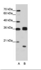 HNRNPH3 / hnRNP H3 Antibody - A: Marker, B: Rap Cell Lysate.  This image was taken for the unconjugated form of this product. Other forms have not been tested.