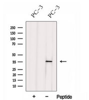 HNRNPH3 / hnRNP H3 Antibody - Western blot analysis of extracts of PC-3 cells using HNRNPH3 antibody. The lane on the left was treated with blocking peptide.