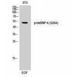 HNRNPK / hnRNP K Antibody - Western blot of Phospho-hnRNP K (S284) antibody