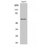 HNRNPK / hnRNP K Antibody - Western blot of hnRNP K antibody