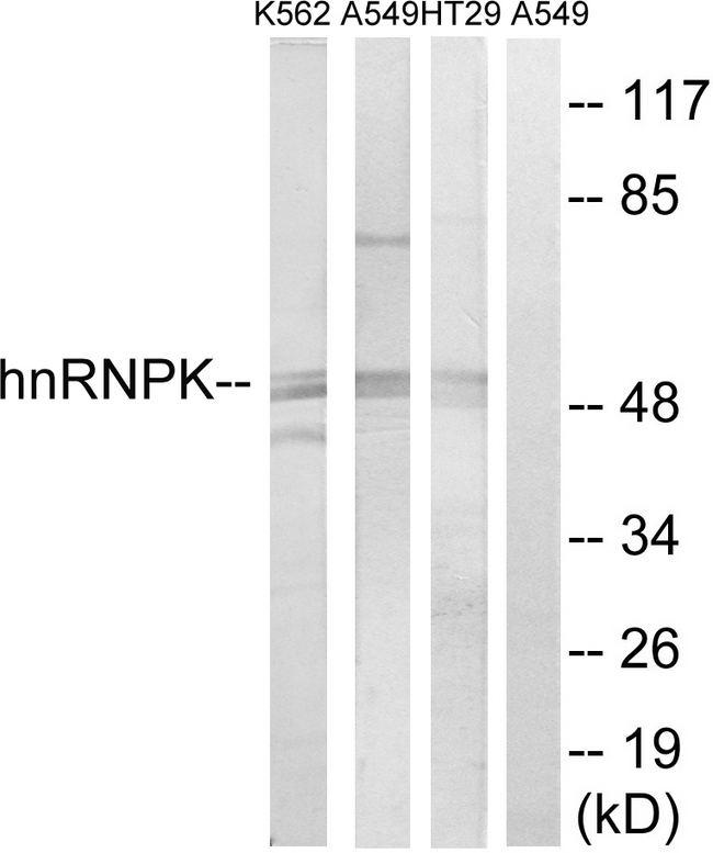 HNRNPK / hnRNP K Antibody - Western blot analysis of lysates from K562, A549, and HT-29 cells, using hnRNP K Antibody. The lane on the right is blocked with the synthesized peptide.