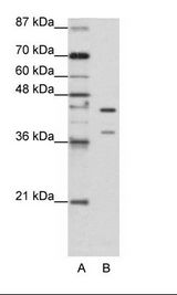 HNRNPK / hnRNP K Antibody - A: Marker, B: HepG2 Cell Lysate.  This image was taken for the unconjugated form of this product. Other forms have not been tested.