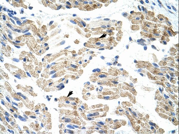 HNRNPK / hnRNP K Antibody - HNRNPK / hnRNP K antibody ARP40387_T100-NP_112552-HNRPK (heterogeneous nuclear ribonucleoprotein K) Antibody was used in IHC to stain formalin-fixed, paraffin-embedded human muscle.  This image was taken for the unconjugated form of this product. Other forms have not been tested.