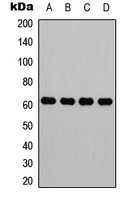 HNRNPK / hnRNP K Antibody - Western blot analysis of hnRNP K expression in HeLa (A); HT29 (B); HepG2 (C); Raw264.7 (D) whole cell lysates.