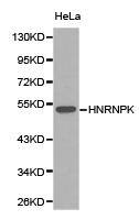 HNRNPK / hnRNP K Antibody - Western blot of extracts of HeLa cell lines, using HNRNPK antibody.