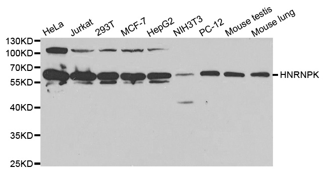 HNRNPK / hnRNP K Antibody - Western blot analysis of extracts of various cell lines.