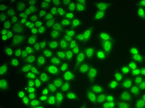 HNRNPK / hnRNP K Antibody - Immunofluorescence analysis of A549 cells.