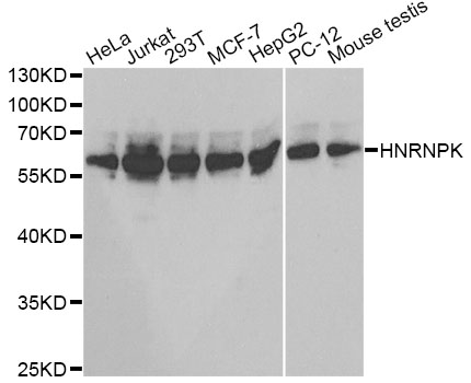 HNRNPK / hnRNP K Antibody - Western blot analysis of extracts of various cell lines, using HNRNPK antibody at 1:1000 dilution. The secondary antibody used was an HRP Goat Anti-Rabbit IgG (H+L) at 1:10000 dilution. Lysates were loaded 25ug per lane and 3% nonfat dry milk in TBST was used for blocking.