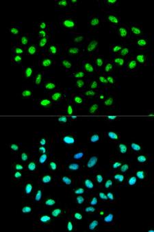 HNRNPK / hnRNP K Antibody - Immunofluorescence analysis of MCF-7 cells using HNRNPK antibody. Blue: DAPI for nuclear staining.