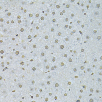 HNRNPK / hnRNP K Antibody - Immunohistochemistry of paraffin-embedded rat liver using HNRNPK Antibodyat dilution of 1:200 (40x lens).