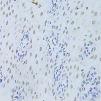 HNRNPK / hnRNP K Antibody - Immunohistochemistry of paraffin-embedded human esophagus using HNRNPK Antibodyat dilution of 1:200 (40x lens).