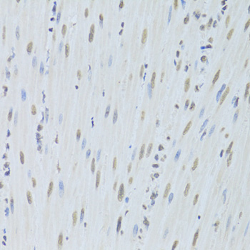 HNRNPK / hnRNP K Antibody - Immunohistochemistry of paraffin-embedded mouse esophagus using HNRNPK Antibodyat dilution of 1:200 (40x lens).