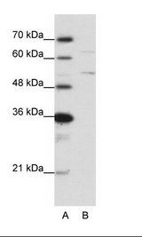 HNRNPK / hnRNP K Antibody - A: Marker, B: HepG2 Cell Lysate.  This image was taken for the unconjugated form of this product. Other forms have not been tested.