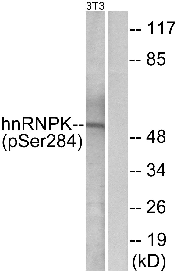 HNRNPK / hnRNP K Antibody - Western blot analysis of lysates from NIH/3T3 cells treated with EGF 200ng/ml 30', using hnRNP K (Phospho-Ser284) Antibody. The lane on the right is blocked with the phospho peptide.