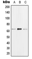 HNRNPK / hnRNP K Antibody - Western blot analysis of hnRNP K (pS284) expression in MCF7 EGF-treated (A); Raw264.7 EGF-treated (B); H9C2 EGF-treated (C) whole cell lysates.