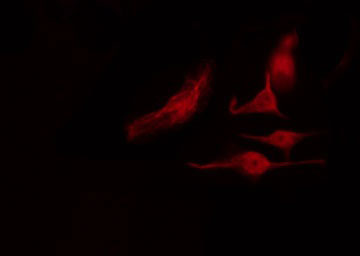 HNRNPK / hnRNP K Antibody - Staining NIH-3T3 cells by IF/ICC. The samples were fixed with PFA and permeabilized in 0.1% Triton X-100, then blocked in 10% serum for 45 min at 25°C. The primary antibody was diluted at 1:200 and incubated with the sample for 1 hour at 37°C. An Alexa Fluor 594 conjugated goat anti-rabbit IgG (H+L) Ab, diluted at 1/600, was used as the secondary antibody.