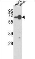 HNRNPL / hnRNP L Antibody - Western blot of HNRPL Antibody in HepG2, Jurkat cell line lysates (35 ug/lane). HNRPL (arrow) was detected using the purified antibody.