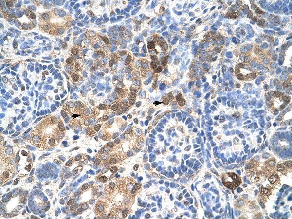 HNRNPL / hnRNP L Antibody - HNRNPL / hnRNP L antibody ARP40367_T100-NP_001524-HNRPL(heterogeneous nuclear ribonucleoprotein L) Antibody was used in IHC to stain formalin-fixed, paraffin-embedded human kidney.  This image was taken for the unconjugated form of this product. Other forms have not been tested.