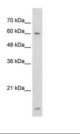 HNRNPL / hnRNP L Antibody - Jurkat Cell Lysate.  This image was taken for the unconjugated form of this product. Other forms have not been tested.