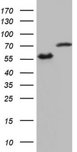 HNRNPL / hnRNP L Antibody - HEK293T cells were transfected with the pCMV6-ENTRY control. (Left lane) or pCMV6-ENTRY HNRNPL. (Right lane) cDNA for 48 hrs and lysed. Equivalent amounts of cell lysates. (5 ug per lane) were separated by SDS-PAGE and immunoblotted with anti-HNRNPL.