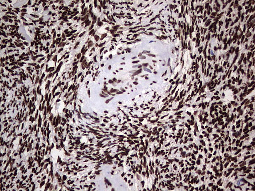 HNRNPL / hnRNP L Antibody - Immunohistochemical staining of paraffin-embedded Human Ovary tissue within the normal limits using anti-HNRNPL mouse monoclonal antibody. (Heat-induced epitope retrieval by 1 mM EDTA in 10mM Tris, pH8.5, 120C for 3min,