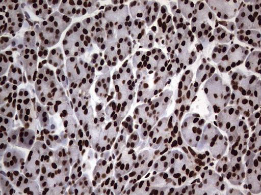 HNRNPL / hnRNP L Antibody - Immunohistochemical staining of paraffin-embedded Human pancreas tissue within the normal limits using anti-HNRNPL mouse monoclonal antibody. (Heat-induced epitope retrieval by 1 mM EDTA in 10mM Tris, pH8.5, 120C for 3min,