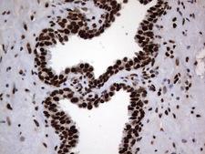 HNRNPL / hnRNP L Antibody - Immunohistochemical staining of paraffin-embedded Human prostate tissue within the normal limits using anti-HNRNPL mouse monoclonal antibody. (Heat-induced epitope retrieval by 1 mM EDTA in 10mM Tris, pH8.5, 120C for 3min,