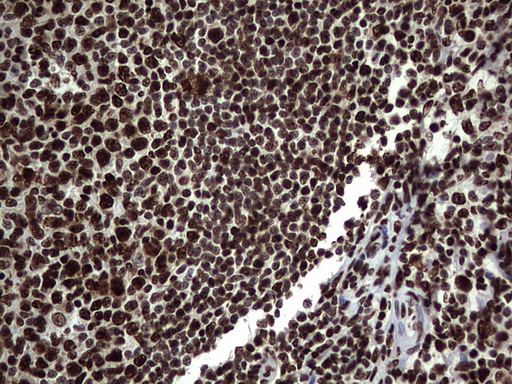 HNRNPL / hnRNP L Antibody - Immunohistochemical staining of paraffin-embedded Human tonsil within the normal limits using anti-HNRNPL mouse monoclonal antibody. (Heat-induced epitope retrieval by 1 mM EDTA in 10mM Tris, pH8.5, 120C for 3min,